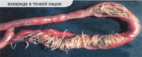 аскаридоз у куриц